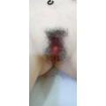 PUBIC HAIR IMPANTED  + $100.00 